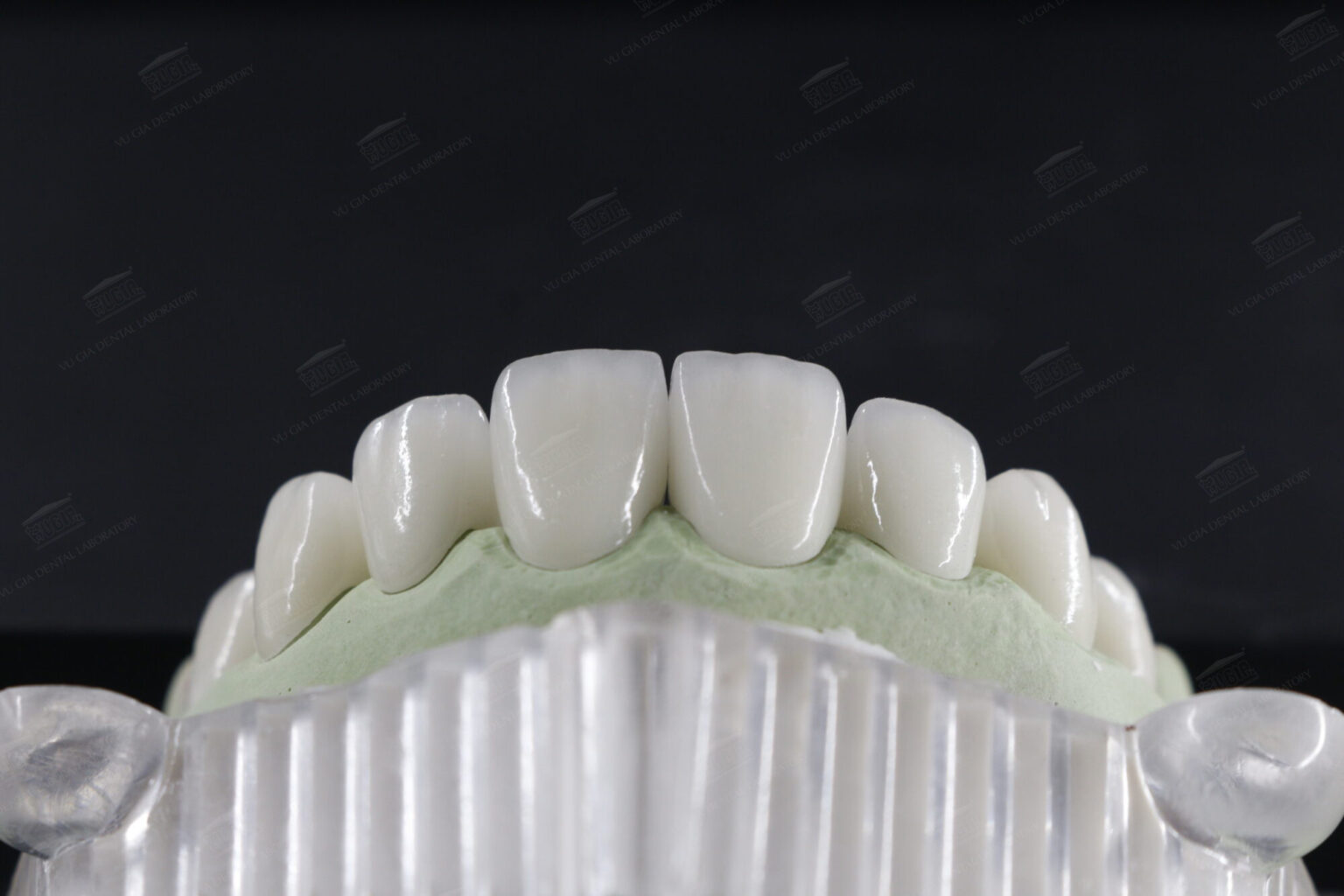 Răng sứ Zirconia
